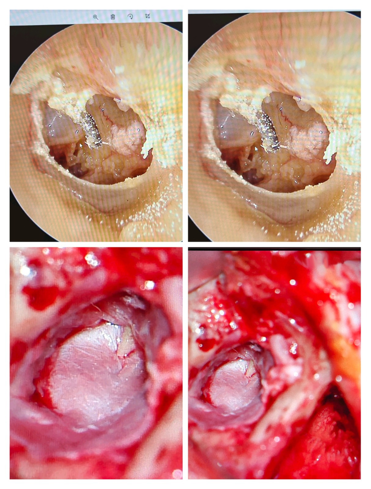 Images depicting the interior of a stomach, relevant to micro ear surgery in ENT practices in Dubai.