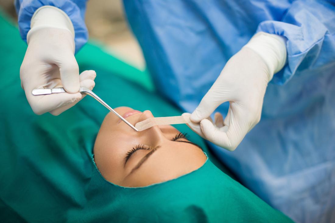 Blocked Nose All the Time? Septoplasty Could Be the Permanent Solution