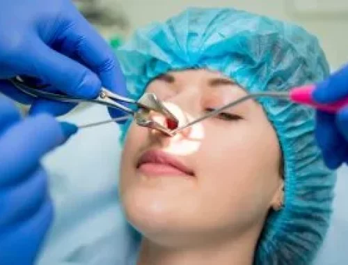 Endoscopic-Sinus-Surgery-1-scaled-1-300x211