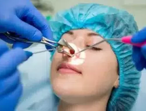 Endoscopic-Sinus-Surgery-1-scaled-1-300x211
